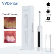 3MP Wireless 8LED 640P Intraoral Endoscope Camera WiFi Dental Oral Camera 20fps