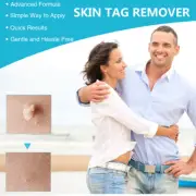 3 In 1 Painless Skin Tag Mole Wart Removal Kit Auto Rubber Bands Remover Tool CR