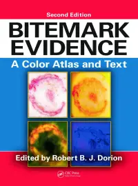 在飛比找博客來優惠-Bitemark Evidence: A Color Atl