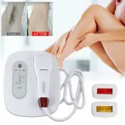 IPL Permanent Body Hair Removal IPL Laser Epilator Skin Rejuvenation Machine