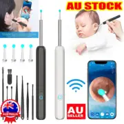 Bebird Ear Wax Removal Ear Cleaning Endoscope Spoon Mini Camera Ear Picker QS