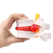 1 PCS Human Lumbar Disc Herniation Model Anatomical Vertebrae Spine For Teaching