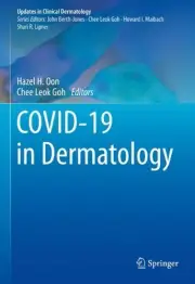 COVID-19 in Dermatology by Hazel H. Oon Hardcover Book