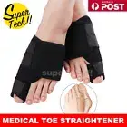 1-2Pair Toe Corrector Strap Orthopedic Hallux Valgus Bunion Straightener Support