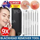 9Pcs Whitehead Blackhead Extractor Pimple Spot Comedone Remover Popper Tool Kit