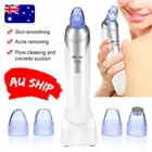 Face Facial Pore Blackhead Remover Vacuum Derma Suction Dermabrasion Sucker AUS