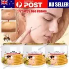 1-3pcs Bee-Venom Wart and Tag Remover Bee-Venom Mole & Wart Treatment-Cream AU