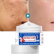 Anti-freckle Cream To Lighten Spots And Melanin To Relieve Dull Skin Tone
