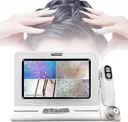 Scalp Hair Follicle Detector,Skin Hair Analyzer,50x/200x Skin Hair Scalp Detector,11-Inch Hd Display-10 Million Pixels,for Facial,Hairdressing,Scalp Care,Home,Beauty Salon,Hair Care Center