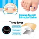 9Pcs/Set Ingrown Toenail Correction Tool Kit Paronychia Toe Nail Fixer Pedic PSG