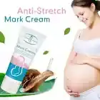 Pregnancy Scar Repair Cream Stretch Marks Removal Fat Stretch Mark 60g x 4pcs