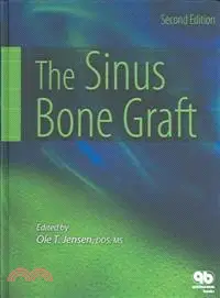 在飛比找三民網路書店優惠-The Sinus Bone Graft