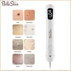 Laser Plasma Skin Tag Remover Pen Wart Dot Dark Spot Mole Tattoo Removal Machine