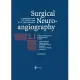 Surgical Neuroangiography: Clinical and Endovascular Treatment Aspects in Adults