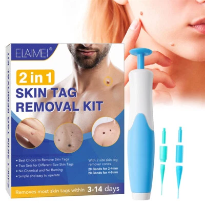 2-8 mm Auto Micro Skin Tag Remover Device Kit Safe Painless Removal Band Tools