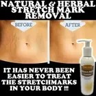 FADE AWAY 250ml STRETCH MARK LOTION REDUCER