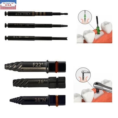 US Implant Fixture Remover Extractor Broken Screw Removal Drill Tap Bar HeaNeam