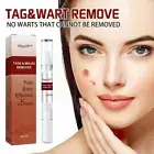 Wipeoff Tags & Moles Remover, wipeoff Tags & Moles Remove Quick-