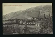 Sanitarium Hotel Banff Alberta - View of Banff Sanitarium on the s- Old Photo