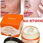 KOJIC Acid Facial Cream Lightening Whitening Skin Pigmentation Dark spots 50ml