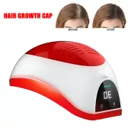 Red Light Laser Hair Growth Helmet Cap Rechargeable Hair Regrowth Treatment Hat