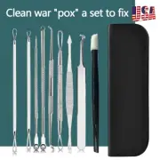 9pcs Blackhead Acne Comedone Pimple Blemish Extractor Remover Tool Kit Set S