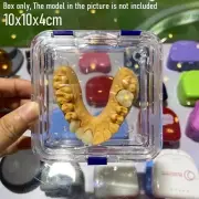 Dental Denture Storage Box Hinged Tooth Boxes Membrane Jewelry Holder Crown Case
