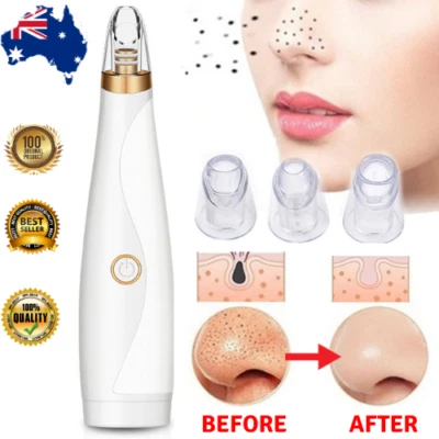 Electric Skin Care Facial Blackhead Remover Pore Suction Vaccum Cleanser Remover