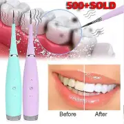 Tooth Stains Tool Dental Scaler Tartar Calculus Plaque Remover Electric Sonic AU