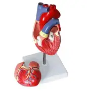 1-1 The Anatomical Model of The Human Heart Has 34 Markers Ultrasound Ultrasound