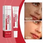 Summer Dark Face Cream Anti Freckle Cream, Facial Spot T5V Removal 20g L2M2