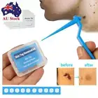 Rubber Bands Face Care Skin Tag Removal Kit Mole Wart Tool Skin Tag Remover
