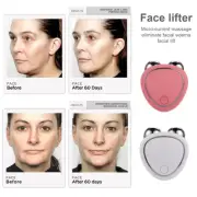 EMS Face Lifting Machine, Facial Massager Microcurrent Roller, Skin Tightening,