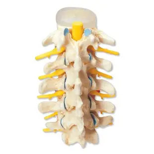 (MD-C73)3B進口椎間盤脫垂及脊椎退行性變模型　接近真骨病理脊椎骨骼模型