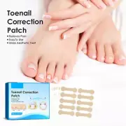 Ingrown Toenail Corrector Stickers Toenail Corrector Patch Nail Correction IDS