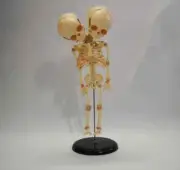 Fetal Fetus Skeleton Teaching Educational Model Double Head Baby Skull Skeleton