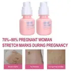 2pcs 40g Postpartum Stretch Marks Cream Stretch Marks Scar Removal Massage C WAS