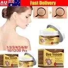30g Mole Remover Wart Removal Tag Recede Bee Venom Treatment Cream For AII Skin