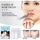 Master Ance Pimple Patches Skin Tag Remover Patch Acne Spot Treatment