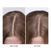Moroccanoil Dry Scalp Treatment 45ml