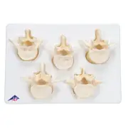 3B Scientific Set of 5 BONElike Lumbar Vertebrae Anatomical Model Anatomy A792