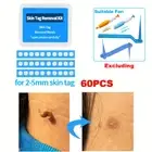 60Pcs Skin Tag Removal Rubber Bands Micro Band Non Toxic Face Care Mole Wafe