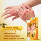 20g New Bee Venom Psoriasis Cream For Relieve Dermatitis Psoriasis Itchy Skin