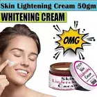 Dark Skin Whitening Dark spot Brightening Bleaching Lightening Face Cream 1.7 oz
