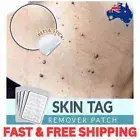 Skin Tag Remover Acne Pimple Patch Removal Facial Care Spot Plaster Blemish