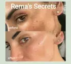 Skin Bleaching Lightening Natural Whitening Bleaching Gel