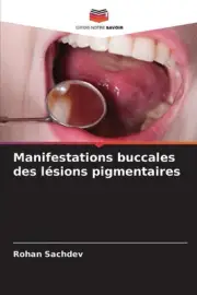 Manifestations buccales des lsions pigmentaires by Rohan Sachdev Paperback Book