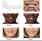 Temporary Teeth New White Removable Reusable Denture Veneers