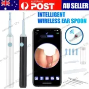 Wifi Visual Earwax Remover Tool Ear Cleaner with Camera 6 LED Ear Wax Borescope
