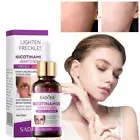 Nicotinamide Whitening Freckle Remove Melasma Dark Spots Face Serum New T9 фц ;*